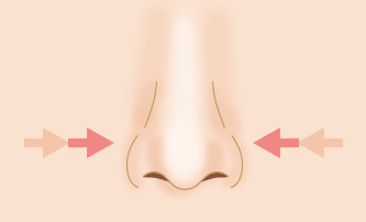 鼻尖縮小術で団子鼻の悩みを改善