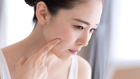 重症・難治性ニキビは美容皮膚科で治療