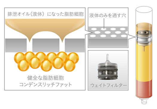 CRFを不純物と分離する遠心分離技術の図