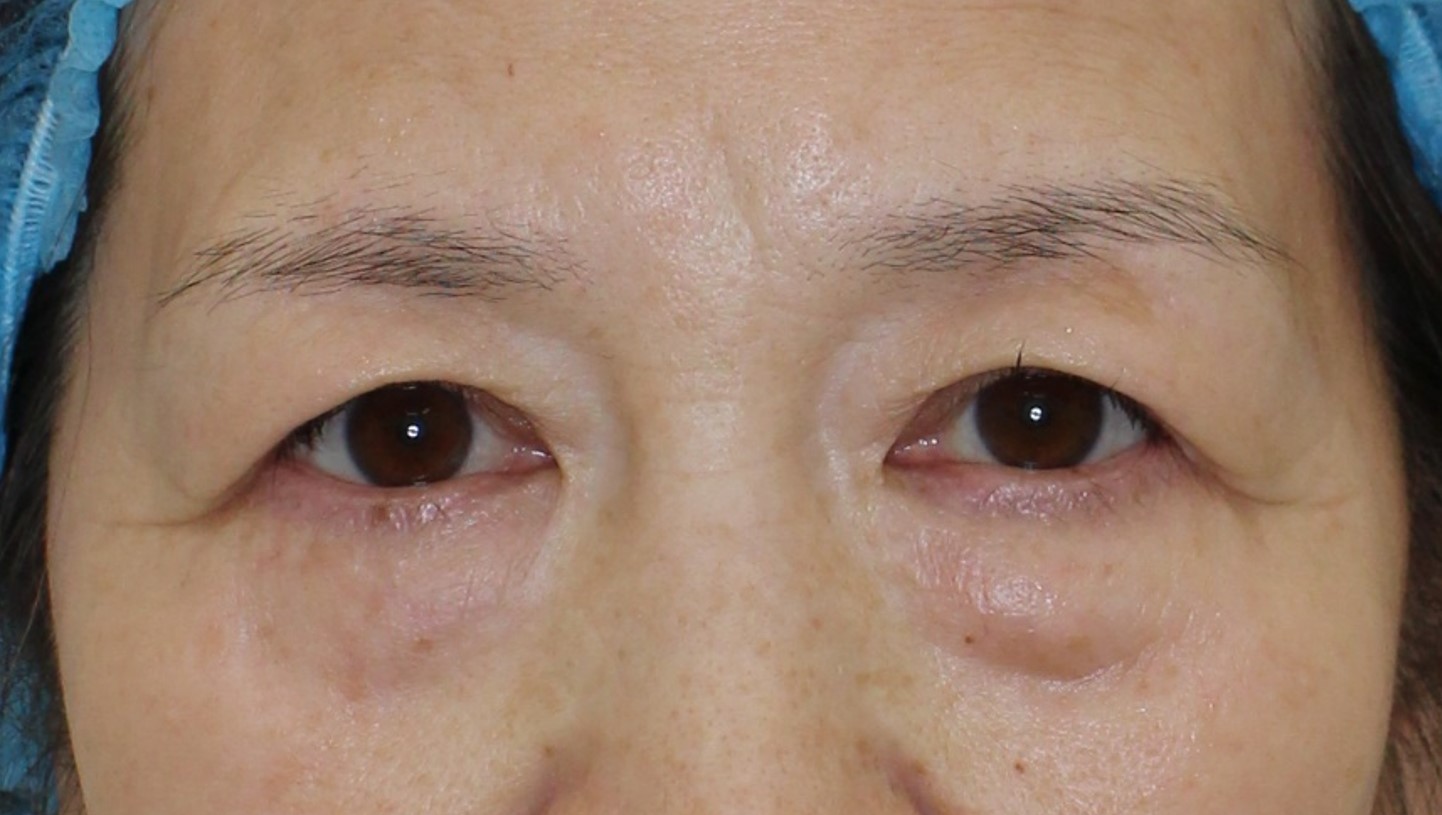 治療前