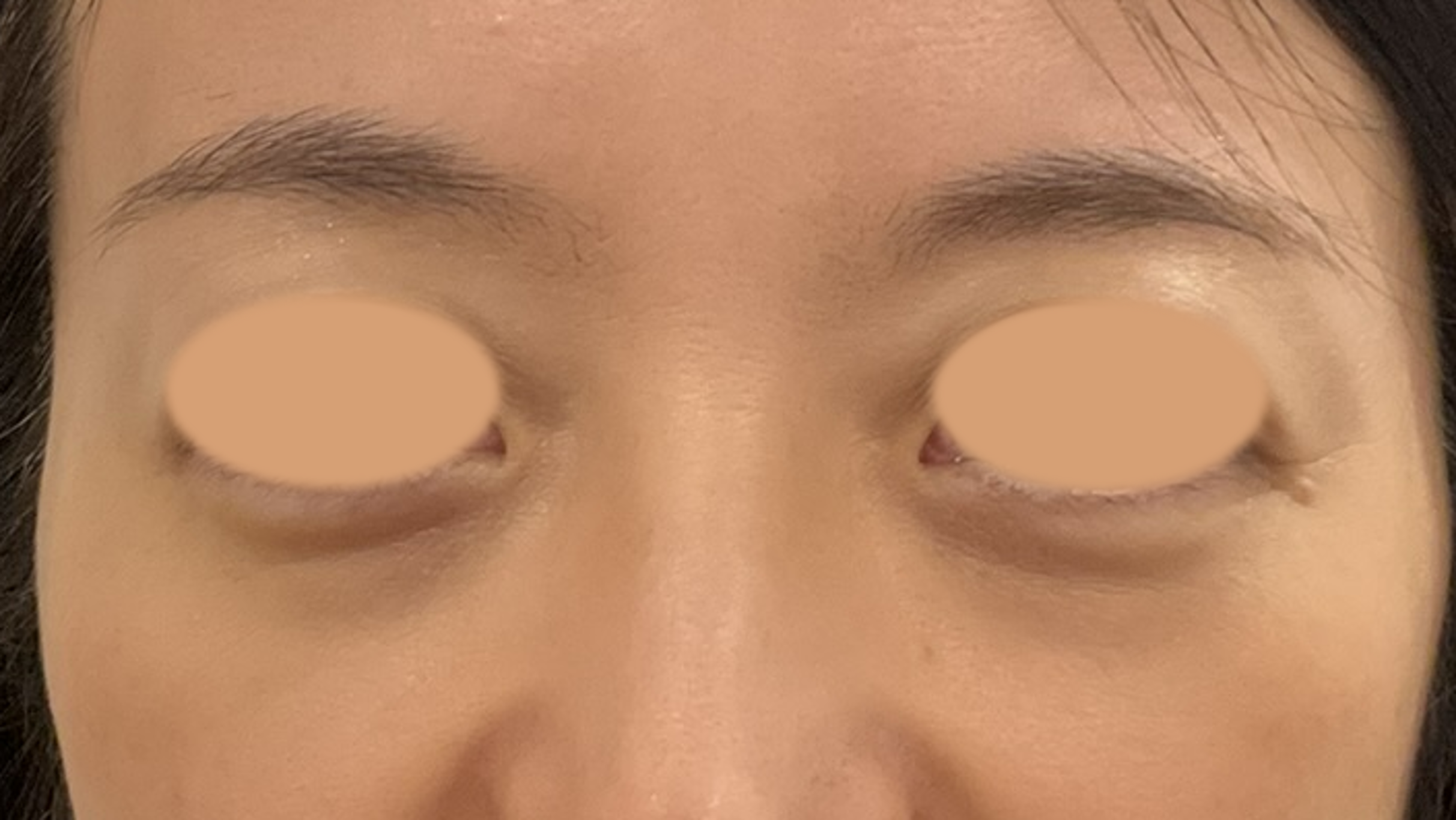 治療前